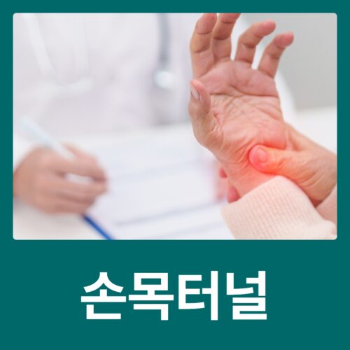 손목터널